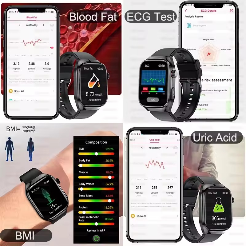 blood glucose monitoring smartwatch