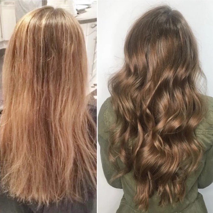 accutane hair loss before and after